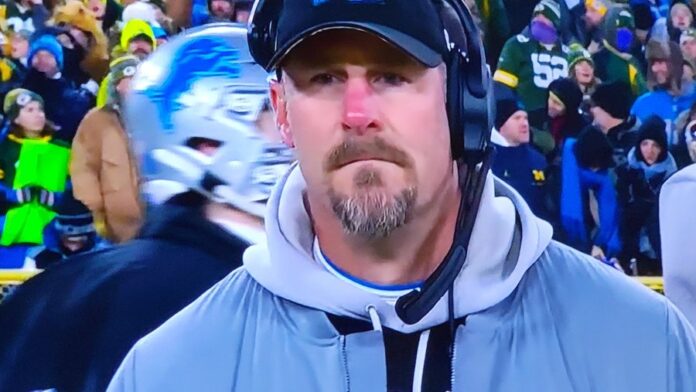 Dan Campbell nose so red that it sparks discussions (Source: X)